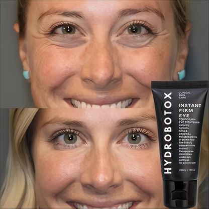 HydroBotox: Crema Lifting Express